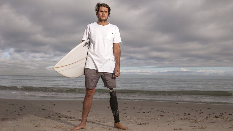 Shark attack survivor wins right to keep tooth left in surfboard